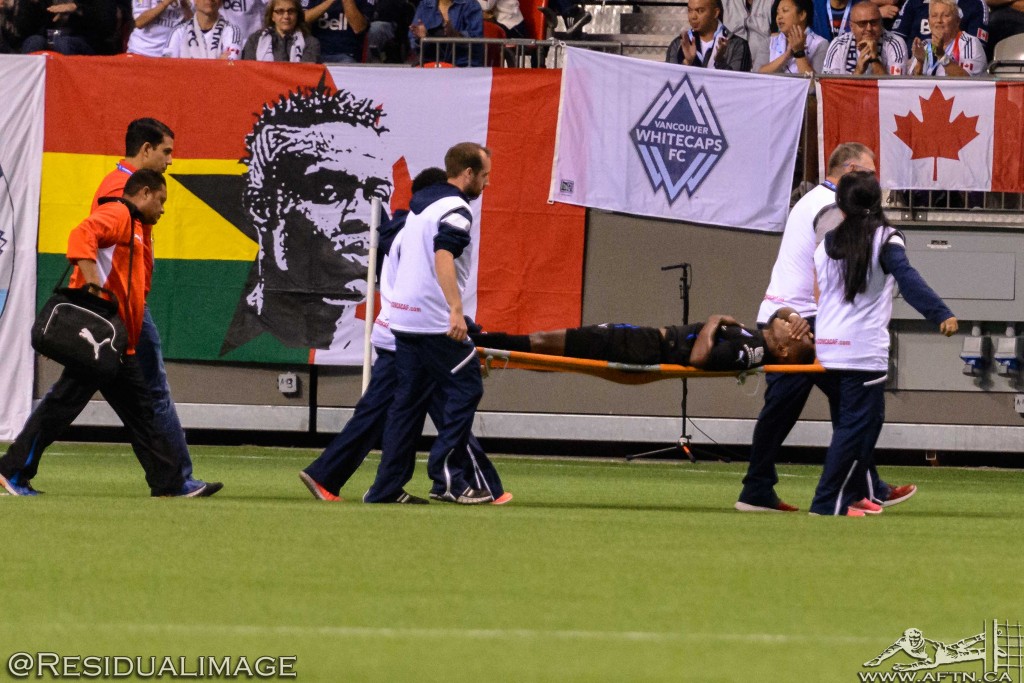 Vancouver Whitecaps v CD Olimpia - The Story In Pictures (113)